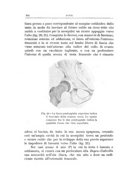 Archivio di ortopedia pubblicazione ufficiale del Pio istituto dei rachitici <1924-1950>