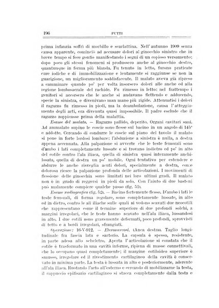 Archivio di ortopedia pubblicazione ufficiale del Pio istituto dei rachitici <1924-1950>