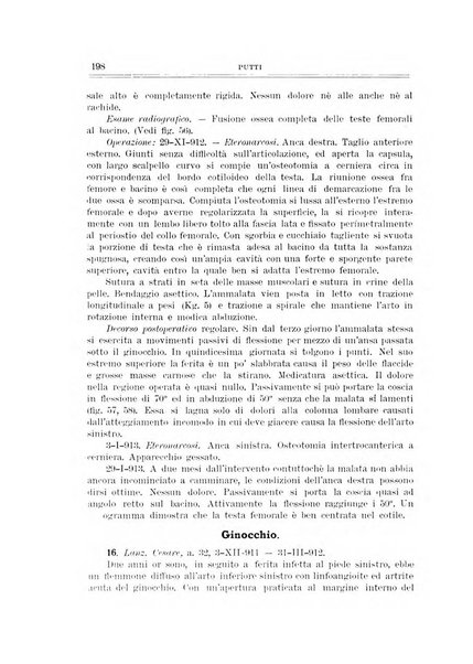 Archivio di ortopedia pubblicazione ufficiale del Pio istituto dei rachitici <1924-1950>