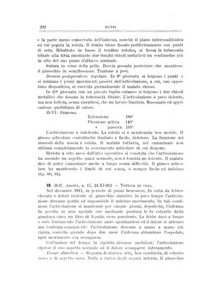 Archivio di ortopedia pubblicazione ufficiale del Pio istituto dei rachitici <1924-1950>