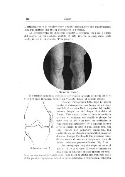 Archivio di ortopedia pubblicazione ufficiale del Pio istituto dei rachitici <1924-1950>