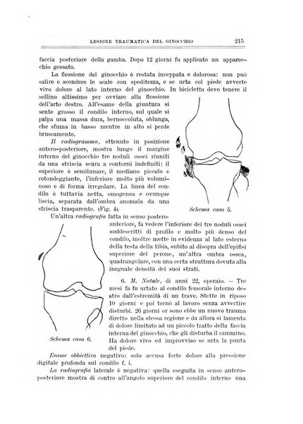 Archivio di ortopedia pubblicazione ufficiale del Pio istituto dei rachitici <1924-1950>