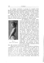 giornale/TO00176849/1913/unico/00000266