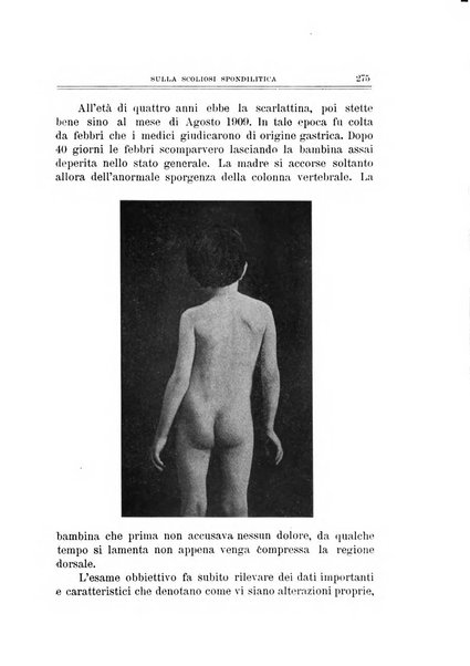 Archivio di ortopedia pubblicazione ufficiale del Pio istituto dei rachitici <1924-1950>