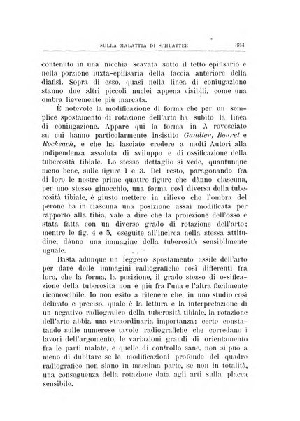 Archivio di ortopedia pubblicazione ufficiale del Pio istituto dei rachitici <1924-1950>