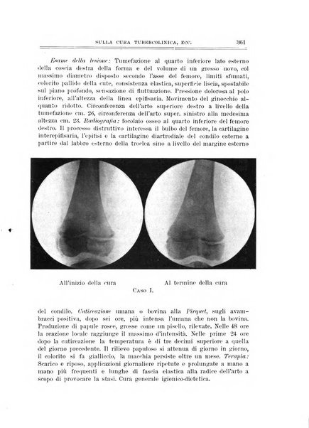 Archivio di ortopedia pubblicazione ufficiale del Pio istituto dei rachitici <1924-1950>