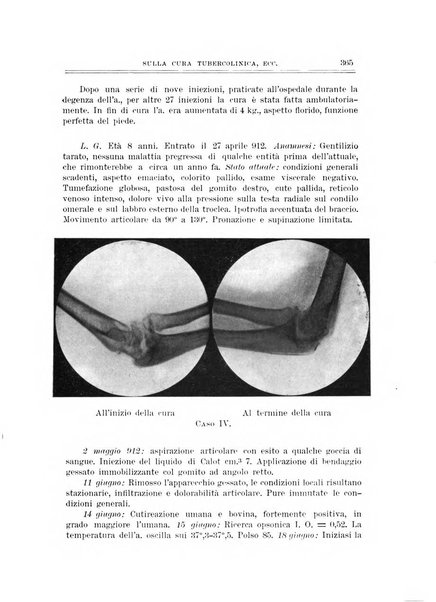 Archivio di ortopedia pubblicazione ufficiale del Pio istituto dei rachitici <1924-1950>