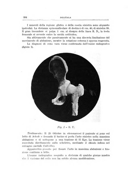 Archivio di ortopedia pubblicazione ufficiale del Pio istituto dei rachitici <1924-1950>