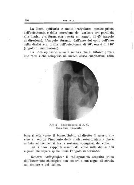 Archivio di ortopedia pubblicazione ufficiale del Pio istituto dei rachitici <1924-1950>