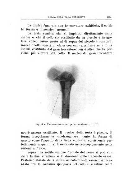 Archivio di ortopedia pubblicazione ufficiale del Pio istituto dei rachitici <1924-1950>