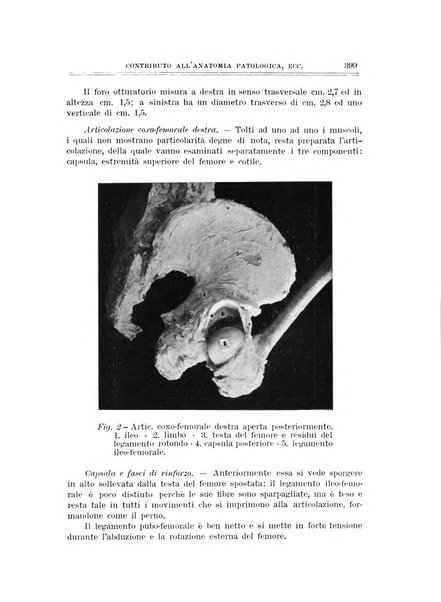 Archivio di ortopedia pubblicazione ufficiale del Pio istituto dei rachitici <1924-1950>