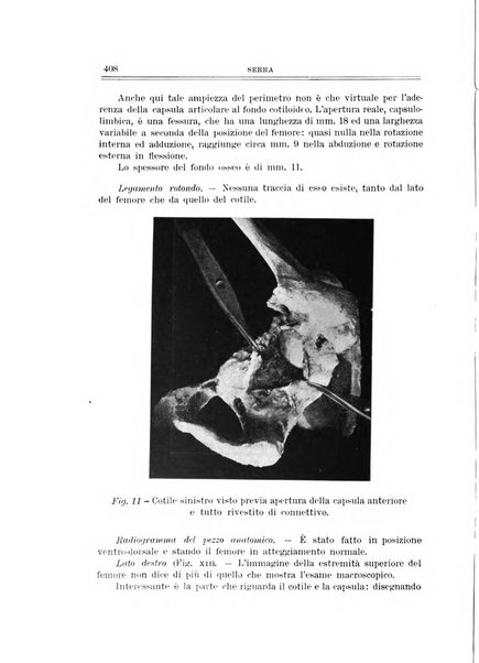 Archivio di ortopedia pubblicazione ufficiale del Pio istituto dei rachitici <1924-1950>