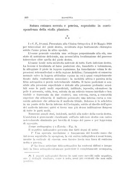 Archivio di ortopedia pubblicazione ufficiale del Pio istituto dei rachitici <1924-1950>