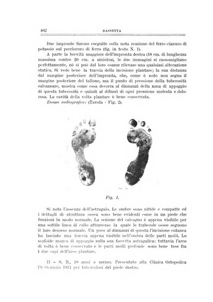 Archivio di ortopedia pubblicazione ufficiale del Pio istituto dei rachitici <1924-1950>