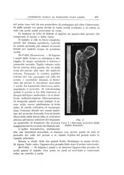 Archivio di ortopedia pubblicazione ufficiale del Pio istituto dei rachitici <1924-1950>