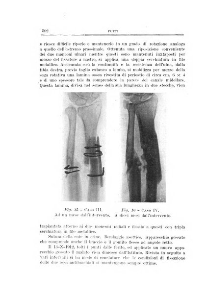 Archivio di ortopedia pubblicazione ufficiale del Pio istituto dei rachitici <1924-1950>