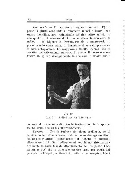 Archivio di ortopedia pubblicazione ufficiale del Pio istituto dei rachitici <1924-1950>