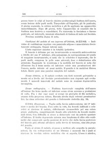 Archivio di ortopedia pubblicazione ufficiale del Pio istituto dei rachitici <1924-1950>