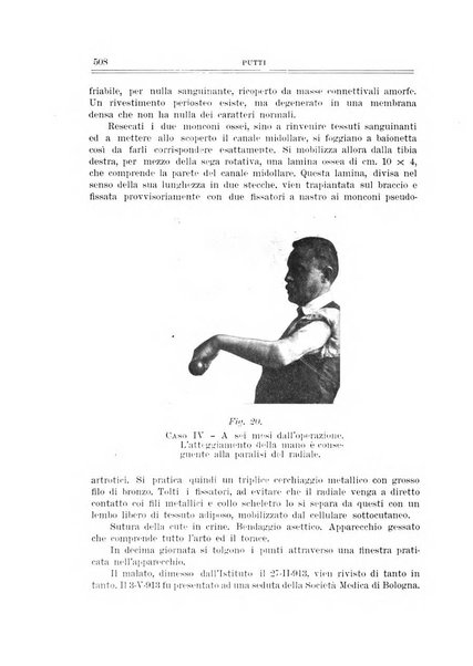 Archivio di ortopedia pubblicazione ufficiale del Pio istituto dei rachitici <1924-1950>