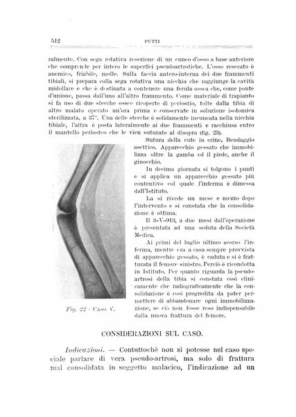 Archivio di ortopedia pubblicazione ufficiale del Pio istituto dei rachitici <1924-1950>