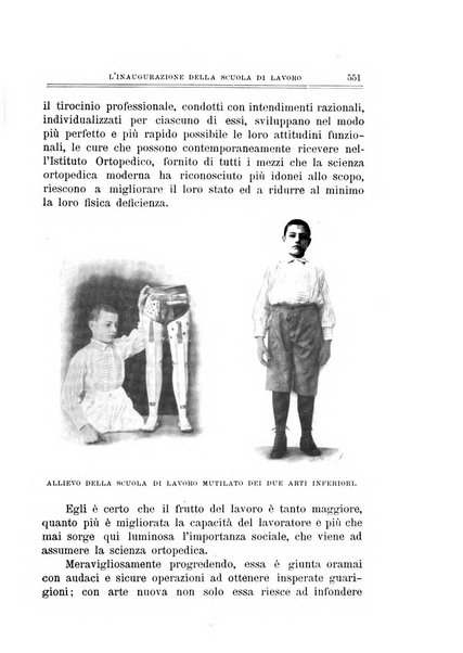 Archivio di ortopedia pubblicazione ufficiale del Pio istituto dei rachitici <1924-1950>