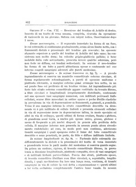 Archivio di ortopedia pubblicazione ufficiale del Pio istituto dei rachitici <1924-1950>