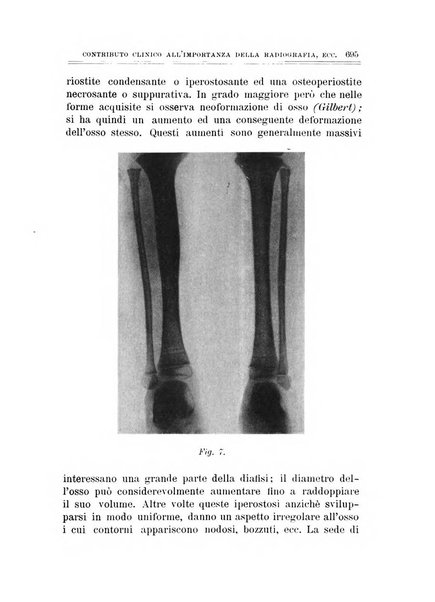 Archivio di ortopedia pubblicazione ufficiale del Pio istituto dei rachitici <1924-1950>