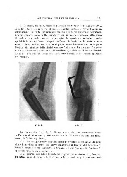 Archivio di ortopedia pubblicazione ufficiale del Pio istituto dei rachitici <1924-1950>