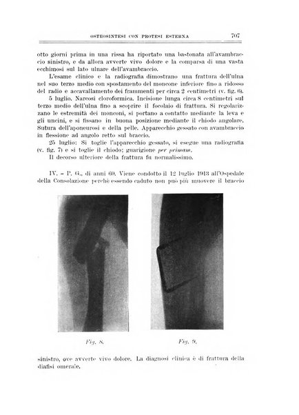 Archivio di ortopedia pubblicazione ufficiale del Pio istituto dei rachitici <1924-1950>