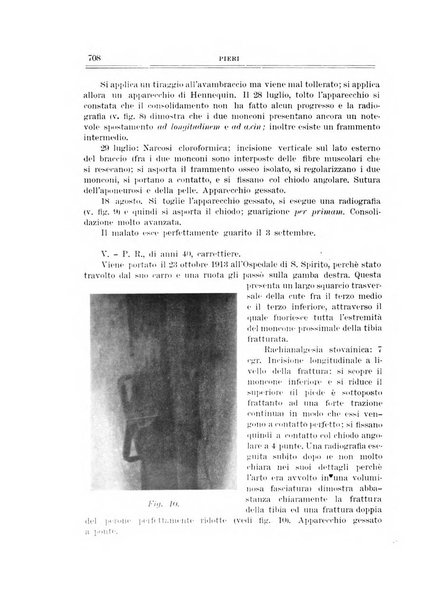 Archivio di ortopedia pubblicazione ufficiale del Pio istituto dei rachitici <1924-1950>