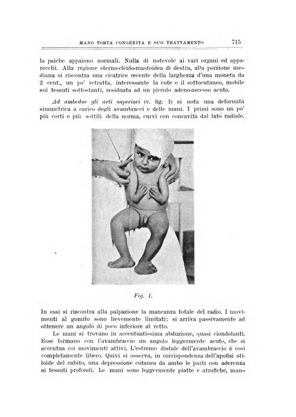 Archivio di ortopedia pubblicazione ufficiale del Pio istituto dei rachitici <1924-1950>