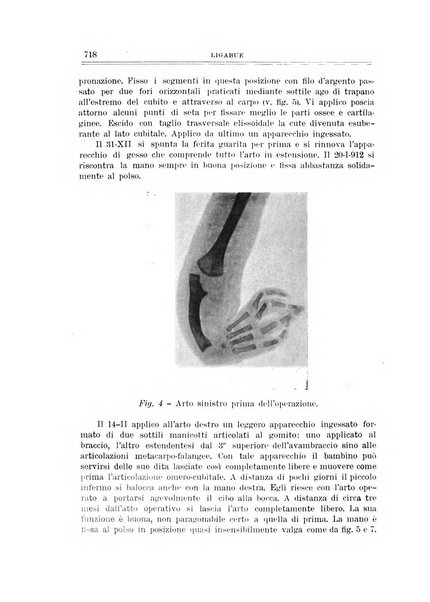 Archivio di ortopedia pubblicazione ufficiale del Pio istituto dei rachitici <1924-1950>