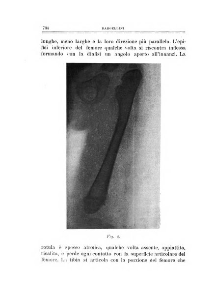 Archivio di ortopedia pubblicazione ufficiale del Pio istituto dei rachitici <1924-1950>