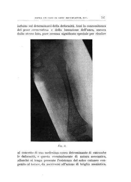 Archivio di ortopedia pubblicazione ufficiale del Pio istituto dei rachitici <1924-1950>