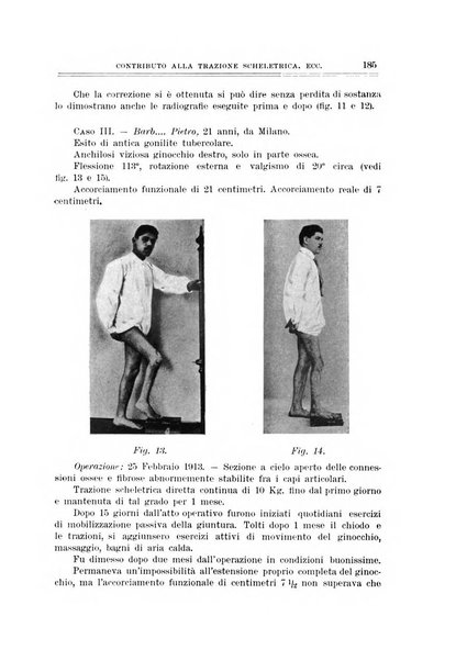 Archivio di ortopedia pubblicazione ufficiale del Pio istituto dei rachitici <1924-1950>