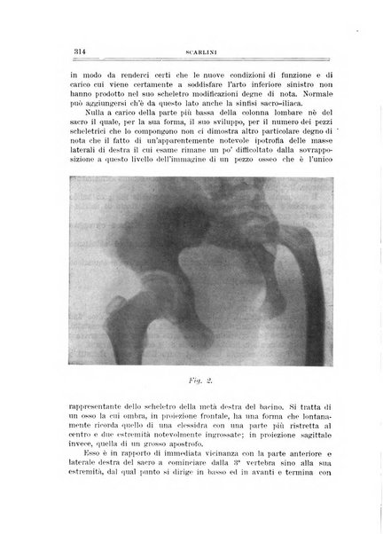 Archivio di ortopedia pubblicazione ufficiale del Pio istituto dei rachitici <1924-1950>