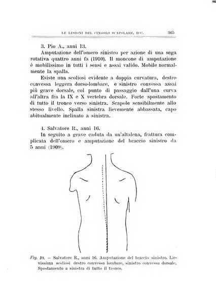 Archivio di ortopedia pubblicazione ufficiale del Pio istituto dei rachitici <1924-1950>