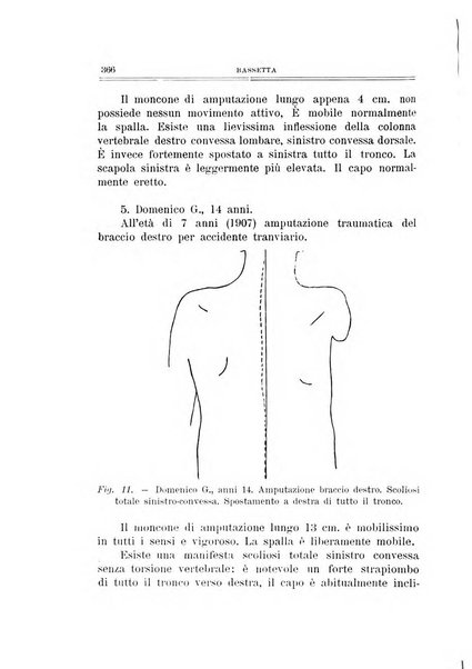 Archivio di ortopedia pubblicazione ufficiale del Pio istituto dei rachitici <1924-1950>