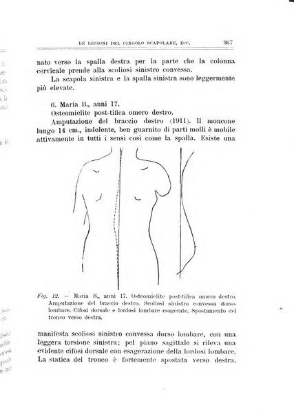 Archivio di ortopedia pubblicazione ufficiale del Pio istituto dei rachitici <1924-1950>