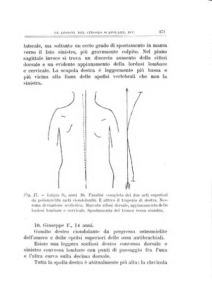 Archivio di ortopedia pubblicazione ufficiale del Pio istituto dei rachitici <1924-1950>