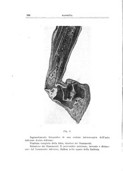 Archivio di ortopedia pubblicazione ufficiale del Pio istituto dei rachitici <1924-1950>