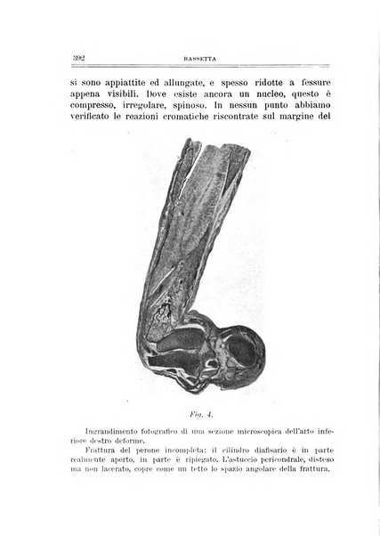 Archivio di ortopedia pubblicazione ufficiale del Pio istituto dei rachitici <1924-1950>