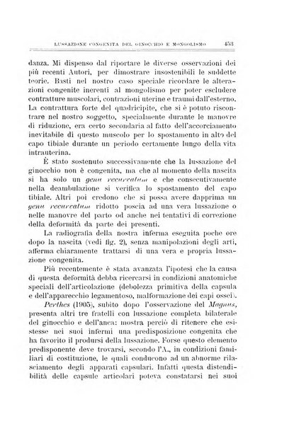 Archivio di ortopedia pubblicazione ufficiale del Pio istituto dei rachitici <1924-1950>