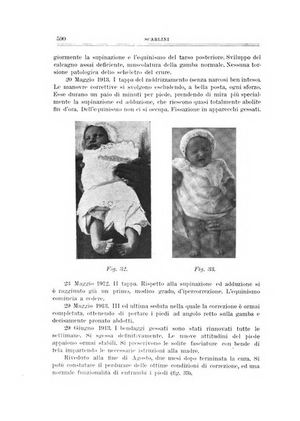 Archivio di ortopedia pubblicazione ufficiale del Pio istituto dei rachitici <1924-1950>