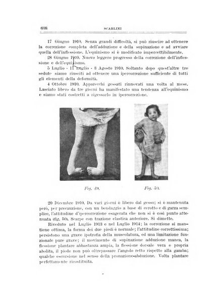 Archivio di ortopedia pubblicazione ufficiale del Pio istituto dei rachitici <1924-1950>