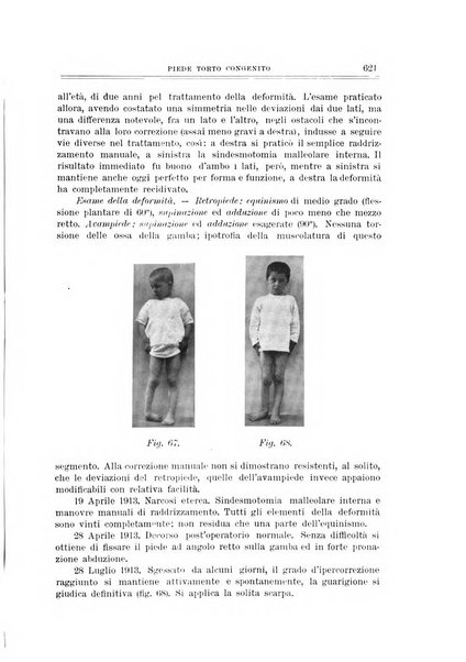 Archivio di ortopedia pubblicazione ufficiale del Pio istituto dei rachitici <1924-1950>