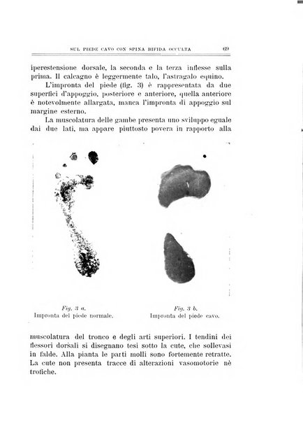 Archivio di ortopedia pubblicazione ufficiale del Pio istituto dei rachitici <1924-1950>