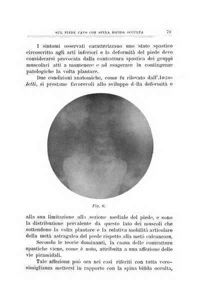 Archivio di ortopedia pubblicazione ufficiale del Pio istituto dei rachitici <1924-1950>