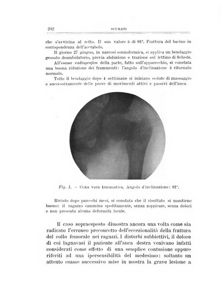 Archivio di ortopedia pubblicazione ufficiale del Pio istituto dei rachitici <1924-1950>