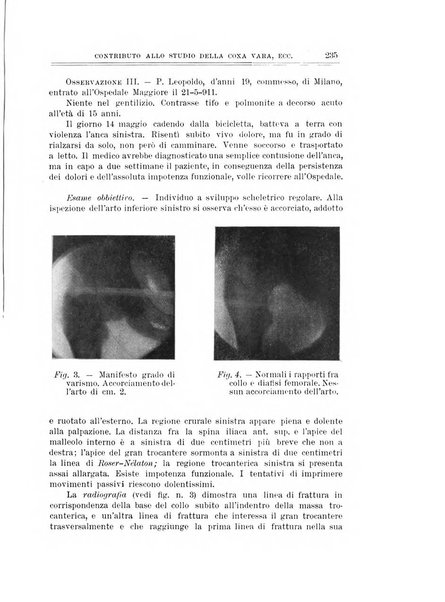 Archivio di ortopedia pubblicazione ufficiale del Pio istituto dei rachitici <1924-1950>